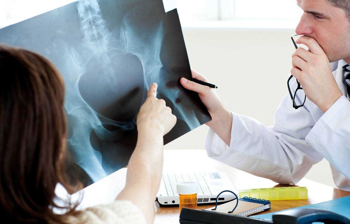 médicos que examinan radiografías por artrose de cadeira