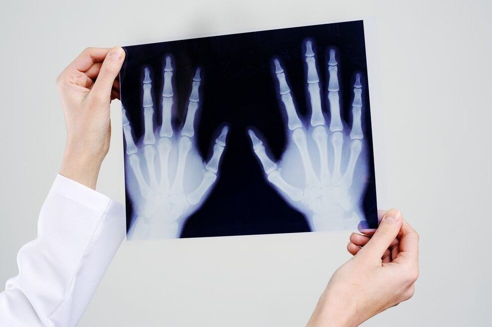 diagnóstico das articulacións da man